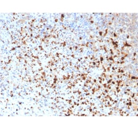 Immunohistochemistry - Anti-HSV1 Antibody [10A3] (A250919) - Antibodies.com