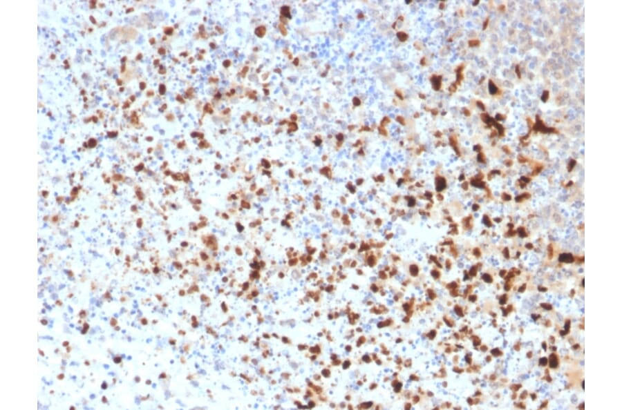 Immunohistochemistry - Anti-HSV1 Antibody [10A3] (A250919) - Antibodies.com