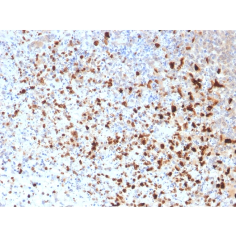 Immunohistochemistry - Anti-HSV1 Antibody [10A3] (A250919) - Antibodies.com