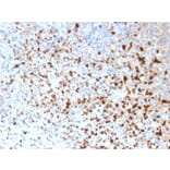Immunohistochemistry - Anti-HSV1 Antibody [10A3] (A250919) - Antibodies.com