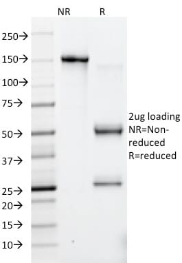 SDS-PAGE analysis of Anti-HSV1 Antibody [10A3] under non-reduced and reduced conditions; showing intact IgG and intact heavy and light chains, respectively. SDS-PAGE analysis confirms the integrity and purity of the antibody.