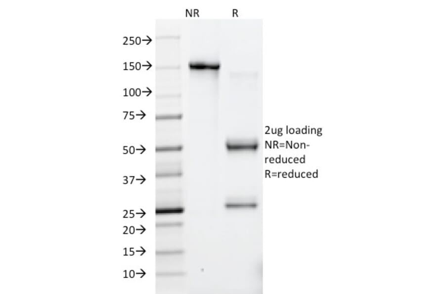 SDS-PAGE - Anti-HSV1 Antibody [10A3] (A250920) - Antibodies.com