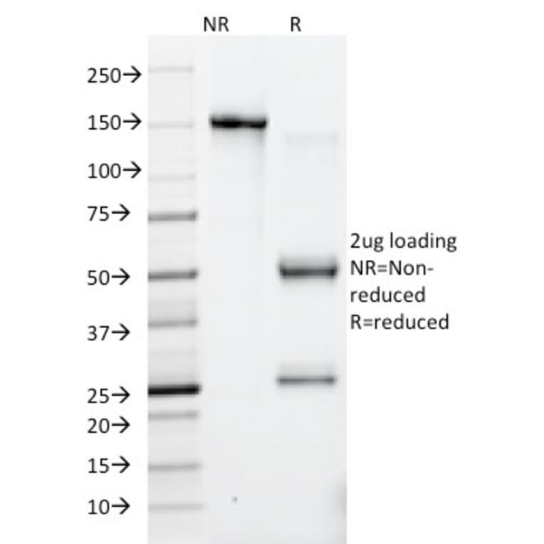 SDS-PAGE - Anti-HSV1 Antibody [10A3] (A250920) - Antibodies.com