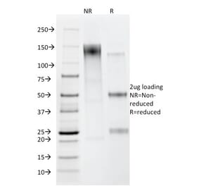 SDS-PAGE - Anti-Helicobacter pylori Antibody [HP/212] (A250920) - Antibodies.com