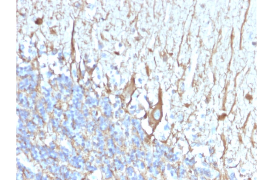 Immunohistochemistry - Anti-Neurofilament Heavy Polypeptide Antibody [2F11] (A250922) - Antibodies.com
