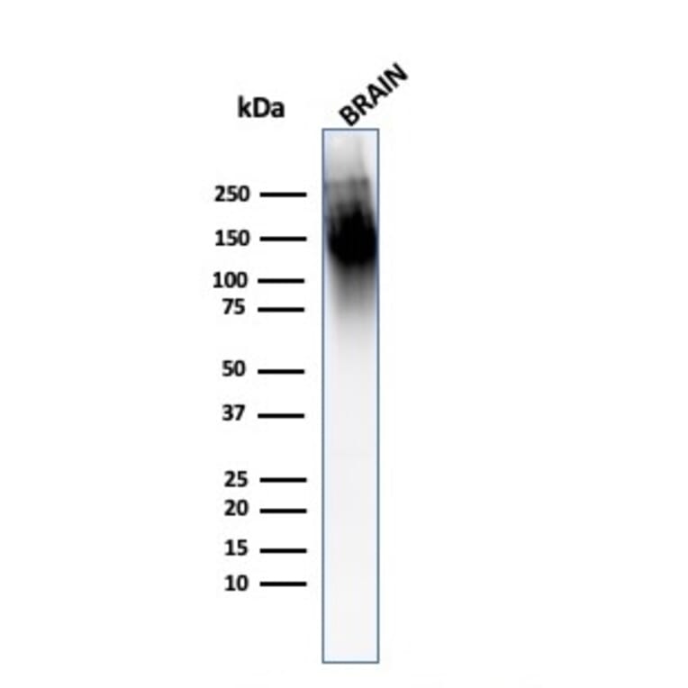 Western Blot - Anti-Neurofilament Heavy Polypeptide Antibody [2F11] (A250923) - Antibodies.com