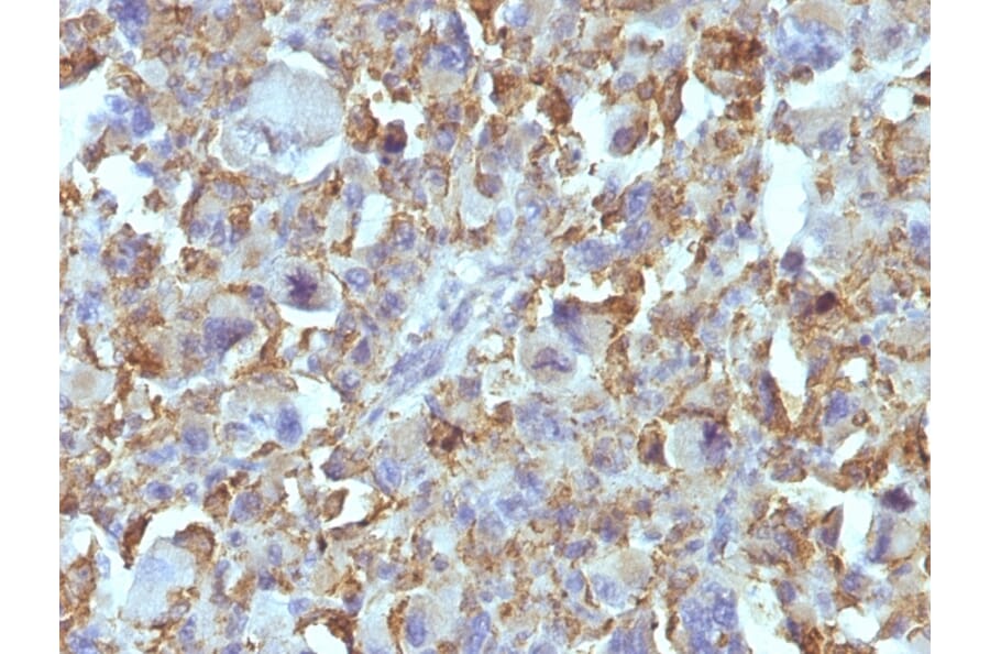 Immunohistochemistry - Anti-Macrophage + Histiocytoma Antibody [D11] (A250926) - Antibodies.com