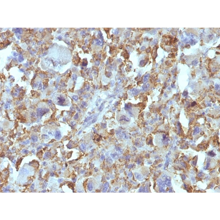 Immunohistochemistry - Anti-Macrophage + Histiocytoma Antibody [D11] (A250926) - Antibodies.com