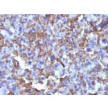 Immunohistochemistry - Anti-Macrophage + Histiocytoma Antibody [D11] (A250925) - Antibodies.com