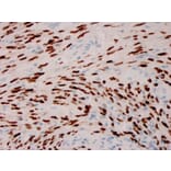 Immunohistochemistry - Anti-HHV8 LNA-1 Antibody [HHV8/3606] (A250926) - Antibodies.com