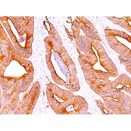 Immunohistochemistry - Anti-pan Cytokeratin Antibody [AE-1/AE-3] (A250928) - Antibodies.com