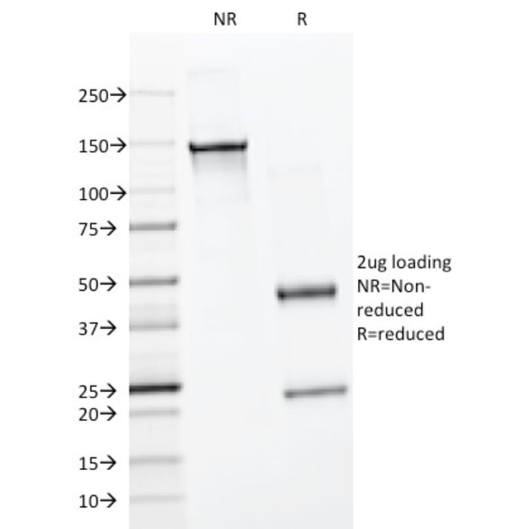 SDS-PAGE - Anti-BrdU Antibody [BRD494] (A250930) - Antibodies.com