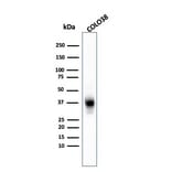 Western Blot - Anti-Melanoma Marker (MART-1 + Tyrosinase + gp100) Antibody [A103 + T311 + HMB45] (A250932) - Antibodies.com