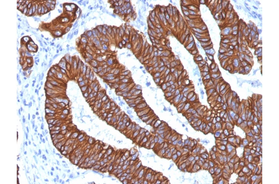Immunohistochemistry - Anti-Cytokeratin 8 + 18 Antibody [KRT8.18/1346] (A250932) - Antibodies.com