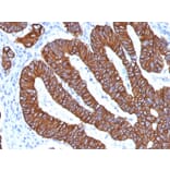 Immunohistochemistry - Anti-Cytokeratin 8 + 18 Antibody [KRT8.18/1346] (A250932) - Antibodies.com