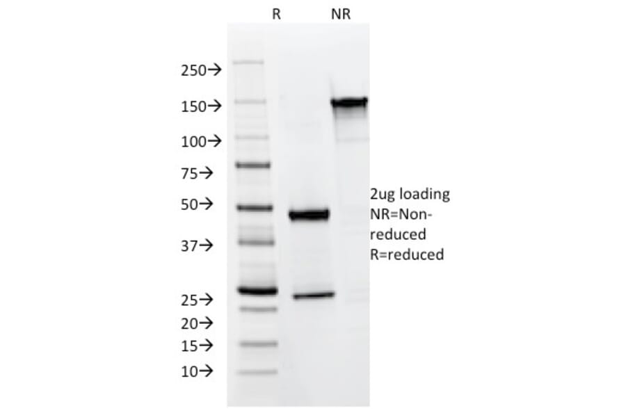 SDS-PAGE - Anti-Cytokeratin 8 + 18 Antibody [KRT8.18/1346] (A250933) - Antibodies.com