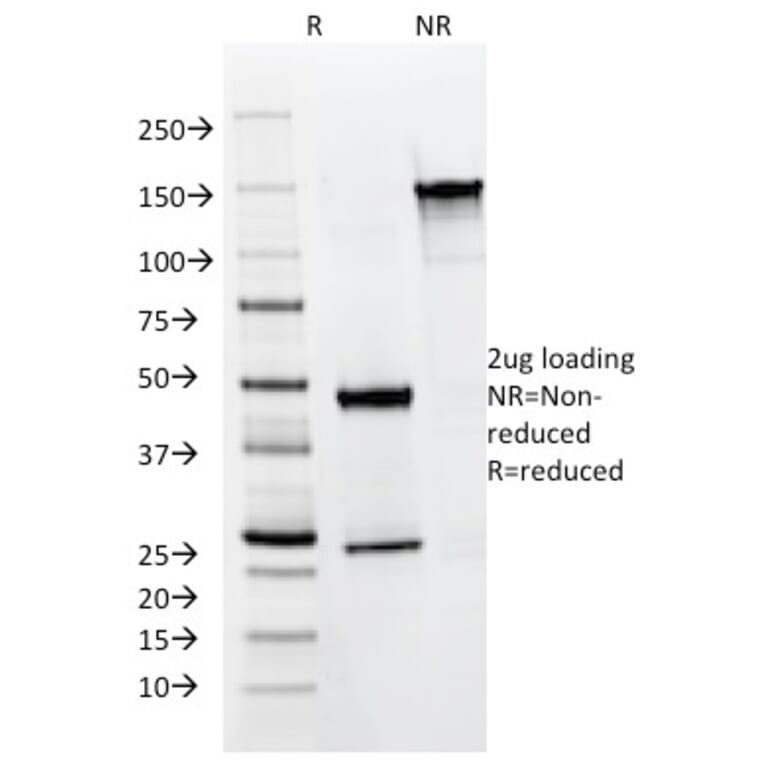 SDS-PAGE - Anti-Cytokeratin 8 + 18 Antibody [KRT8.18/1346] (A250933) - Antibodies.com