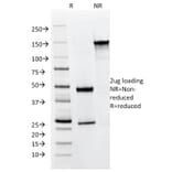 SDS-PAGE - Anti-Cytokeratin 8 + 18 Antibody [KRT8.18/1346] (A250933) - Antibodies.com