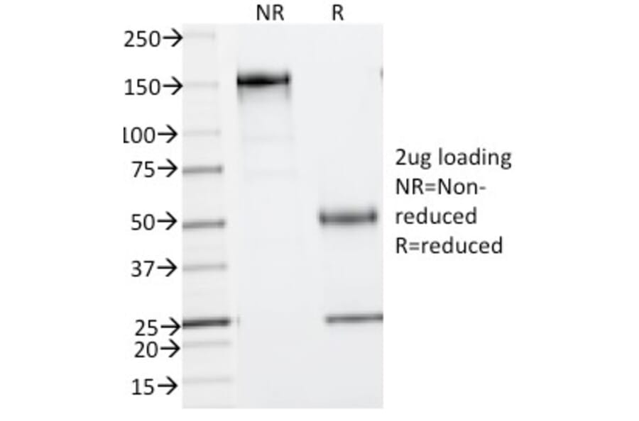 SDS-PAGE - Anti-Phosphotyrosine Antibody [PY793] (A250935) - Antibodies.com