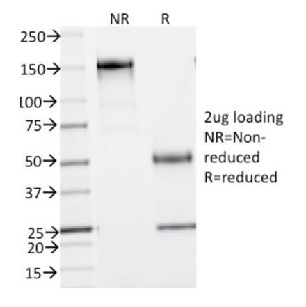 SDS-PAGE - Anti-Phosphotyrosine Antibody [PY793] (A250935) - Antibodies.com