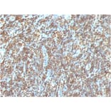 Immunohistochemistry - Anti-ds DNA Antibody [AE-2] (A250938) - Antibodies.com