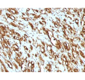 Immunohistochemistry - Anti-Muscle Actin Antibody [MSA/953] (A250939) - Antibodies.com