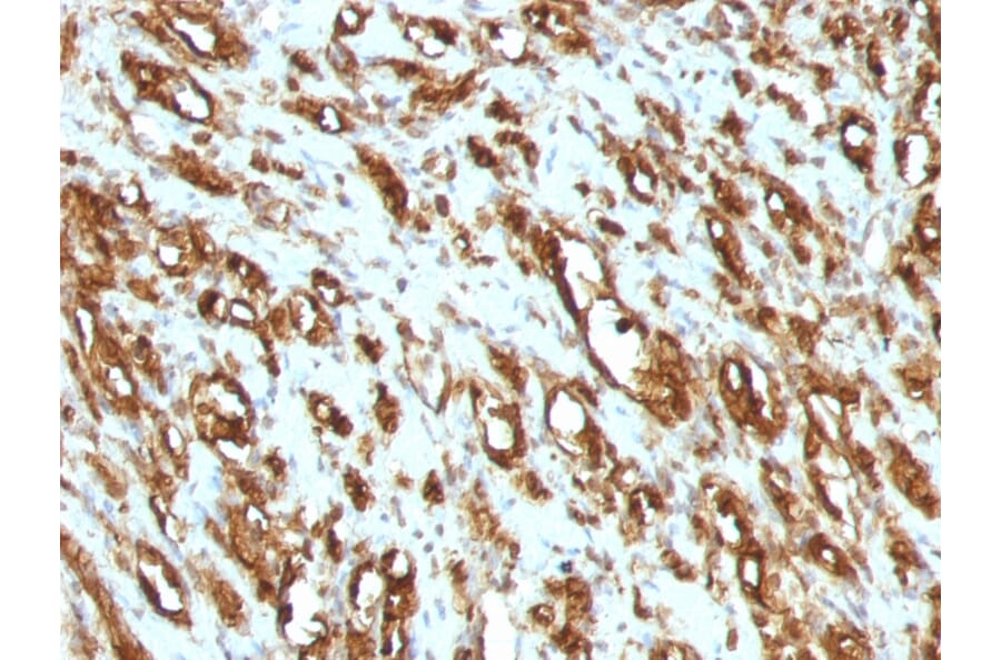 Immunohistochemistry - Anti-Muscle Actin Antibody [MSA/953] (A250939) - Antibodies.com
