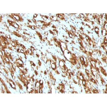 Immunohistochemistry - Anti-Muscle Actin Antibody [MSA/953] (A250939) - Antibodies.com