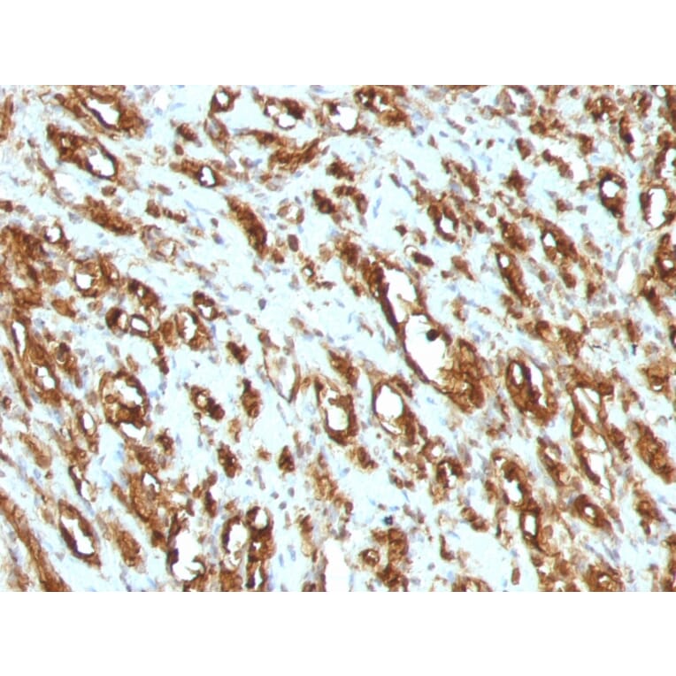 Immunohistochemistry - Anti-Muscle Actin Antibody [MSA/953] (A250939) - Antibodies.com