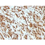 Immunohistochemistry - Anti-Muscle Actin Antibody [MSA/953] (A250939) - Antibodies.com