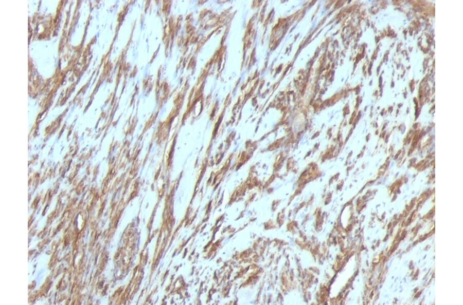 Immunohistochemistry - Anti-Muscle Actin Antibody [MSA/953] (A250938) - Antibodies.com