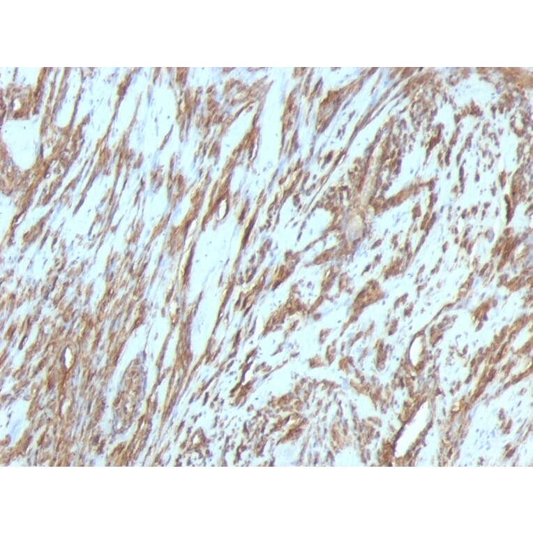 Immunohistochemistry - Anti-Muscle Actin Antibody [MSA/953] (A250938) - Antibodies.com