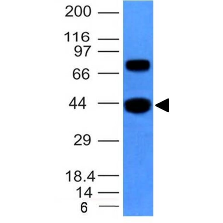 Western Blot - Anti-Muscle Actin Antibody [MSA/953] (A250939) - Antibodies.com