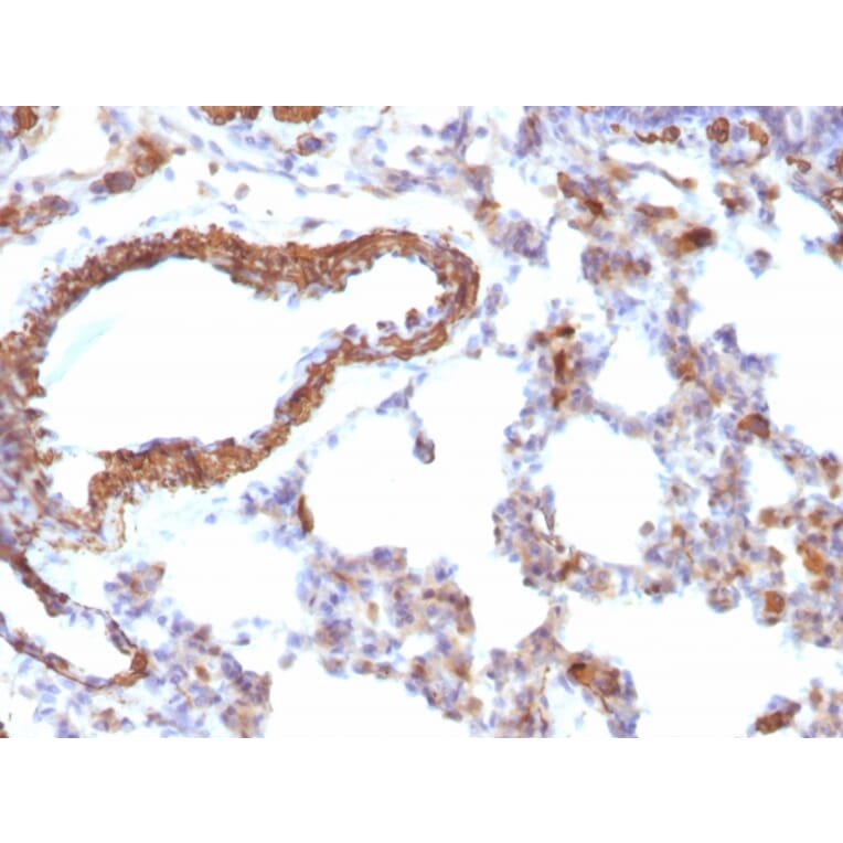 Immunohistochemistry - Anti-Muscle Actin Antibody [MSA/953] (A250939) - Antibodies.com