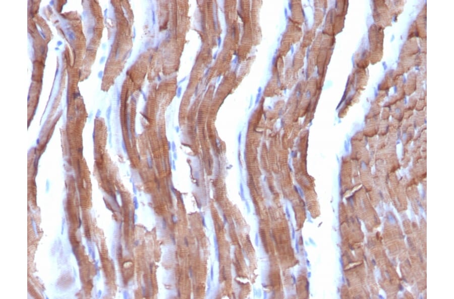Immunohistochemistry - Anti-Muscle Actin Antibody [MSA/953] (A250939) - Antibodies.com