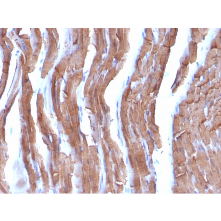 Immunohistochemistry - Anti-Muscle Actin Antibody [MSA/953] (A250939) - Antibodies.com