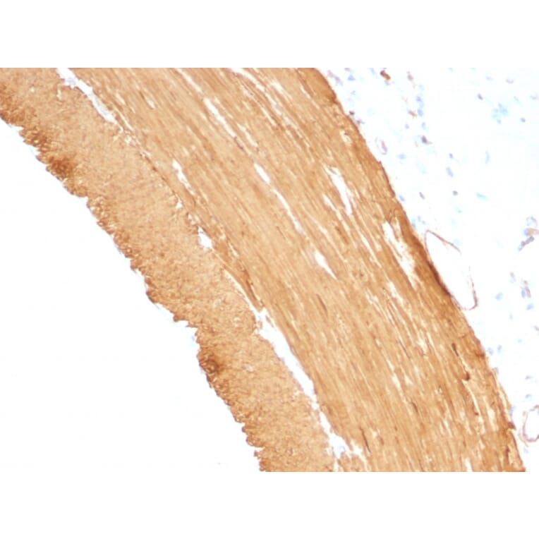 Immunohistochemistry - Anti-Muscle Actin Antibody [MSA/953] (A250939) - Antibodies.com