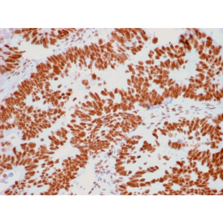 Immunohistochemistry - Anti-Human Nucleolar Antigen Antibody [NM95] (A250940) - Antibodies.com