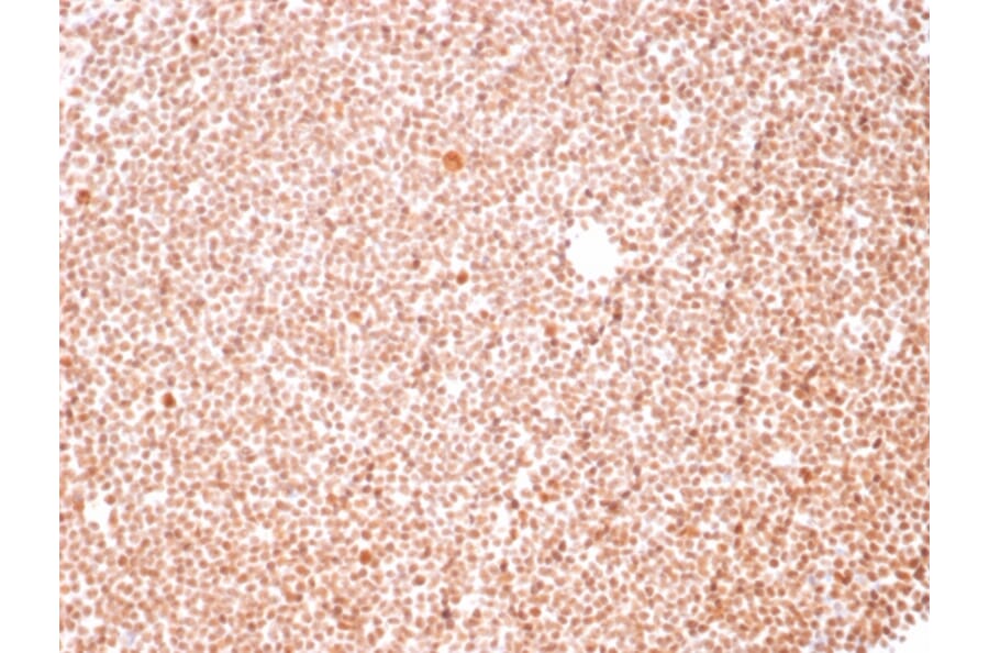 Immunohistochemistry - Anti-Human Nucleolar Antigen Antibody [NM95] (A250940) - Antibodies.com
