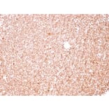 Immunohistochemistry - Anti-Human Nucleolar Antigen Antibody [NM95] (A250940) - Antibodies.com