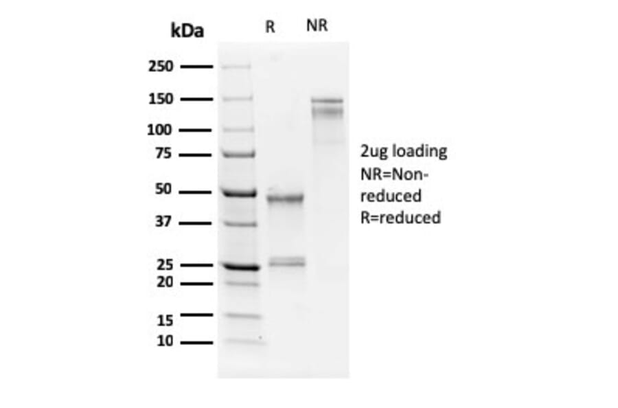 SDS-PAGE - Anti-Human Nucleolar Antigen Antibody [NM95] (A250940) - Antibodies.com