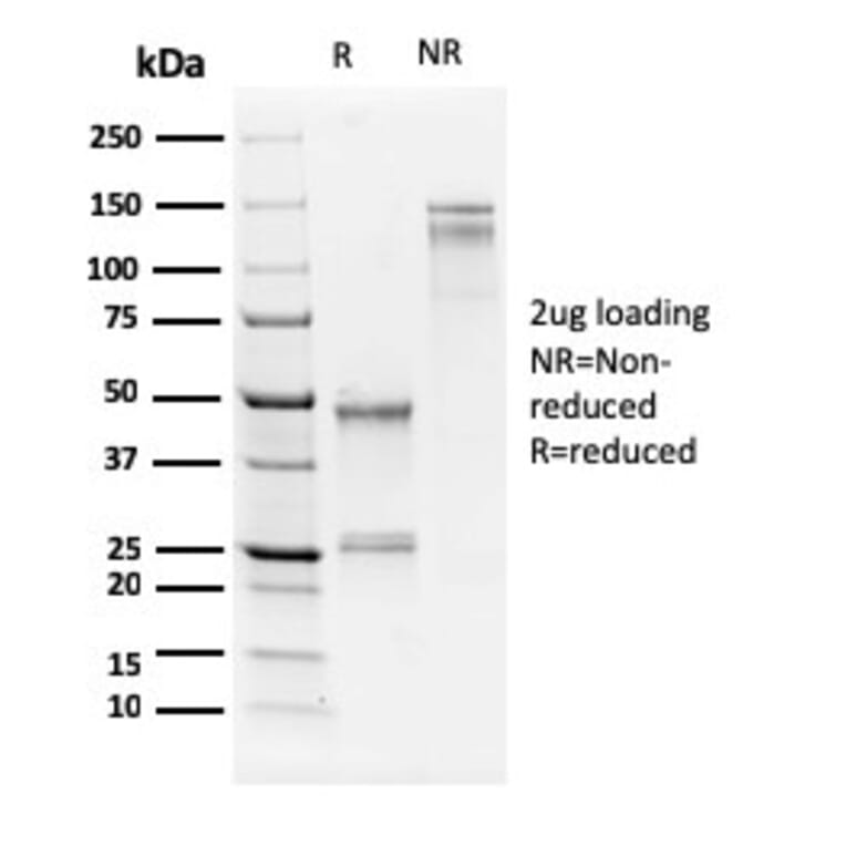 SDS-PAGE - Anti-Human Nucleolar Antigen Antibody [NM95] (A250940) - Antibodies.com