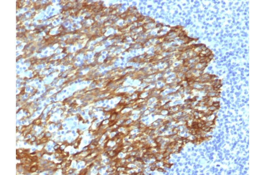 Immunohistochemistry - Anti-Keratin 76 Antibody [DE-SQ] (A252159) - Antibodies.com