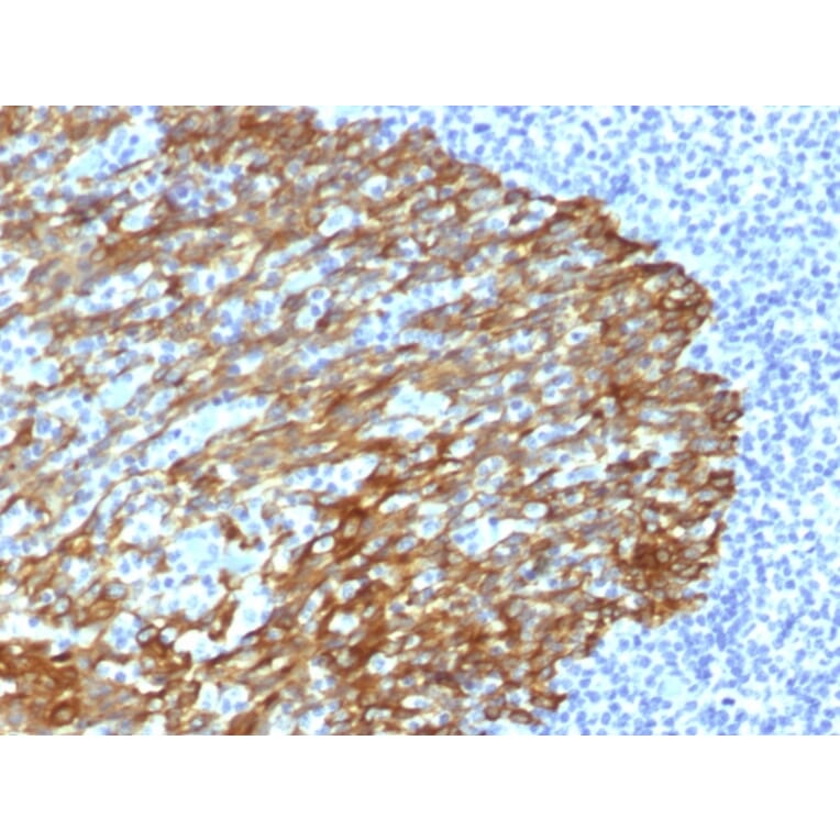 Immunohistochemistry - Anti-Keratin 76 Antibody [DE-SQ] (A252159) - Antibodies.com