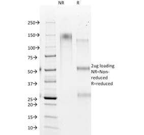 SDS-PAGE - Anti-Hepatocyte Specific Antigen Antibody [HSA98] (A250941) - Antibodies.com