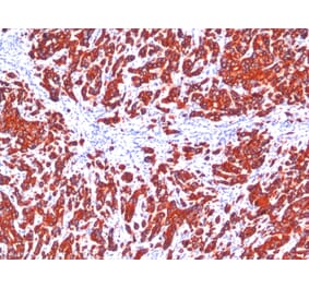 Immunohistochemistry - Anti-pan Cytokeratin Antibody [SPM115 + SPM116] (A254019) - Antibodies.com