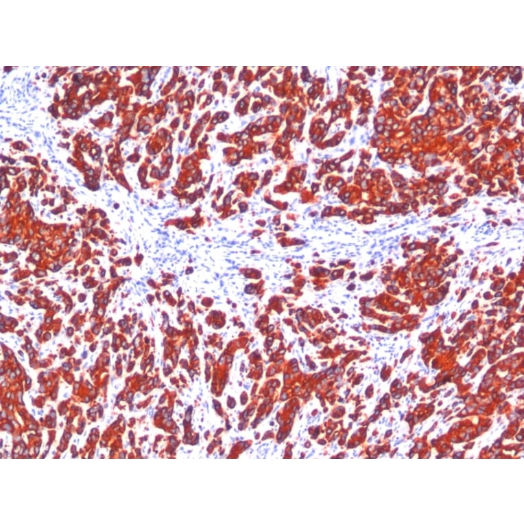 Immunohistochemistry - Anti-pan Cytokeratin Antibody [SPM115 + SPM116] (A250943) - Antibodies.com