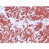 Immunohistochemistry - Anti-pan Cytokeratin Antibody [SPM115 + SPM116] (A250943) - Antibodies.com