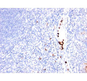 Immunohistochemistry - Anti-Macrophage + Granulocyte Antibody [SPM250] (A250945) - Antibodies.com