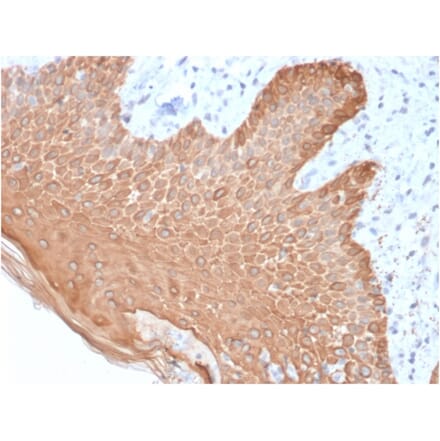 Immunohistochemistry - Anti-pan Cytokeratin Antibody [rKRT/457] (A250946) - Antibodies.com